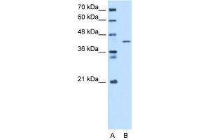 WB Suggested Anti-SEPHS1 Antibody Titration:  5. (SEPHS1 Antikörper  (C-Term))