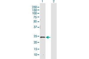 Western Blot analysis of CBR4 expression in transfected 293T cell line by CBR4 MaxPab polyclonal antibody. (CBR4 Antikörper  (AA 1-237))