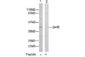 Image no. 2 for anti-Jun B Proto-Oncogene (JUNB) (Ser259) antibody (ABIN197141) (JunB Antikörper  (Ser259))
