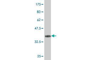 Western Blot detection against Immunogen (37. (ZNF214 Antikörper  (AA 210-319))