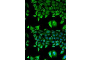 Immunofluorescence analysis of A549 cell using IL17F antibody. (IL17F Antikörper)
