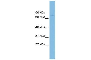 RAI16 antibody used at 1 ug/ml to detect target protein. (FAM160B2 Antikörper  (N-Term))