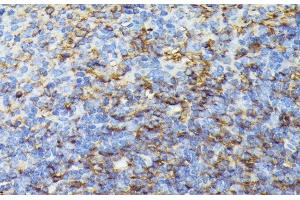 Immunohistochemistry of paraffin-embedded Mouse spleen using COX15 Polyclonal Antibody at dilution of 1:100 (40x lens). (COX15 Antikörper)