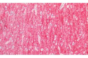 Detection of ICAM5 in Human Cortex Tissue using Polyclonal Antibody to Intercellular Adhesion Molecule 5 (ICAM5) (ICAM5 Antikörper  (AA 409-674))
