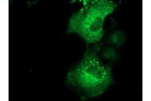 Anti-QPRT mouse monoclonal antibody (ABIN2453564) immunofluorescent staining of COS7 cells transiently transfected by pCMV6-ENTRY QPRT (RC202960). (QPRT Antikörper)