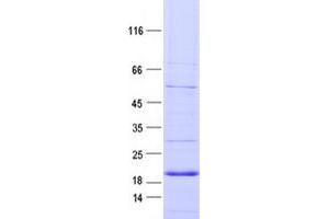 Western Blotting (WB) image for Insulin Receptor-Related Receptor (INSRR) protein (DYKDDDDK Tag) (ABIN2723505)