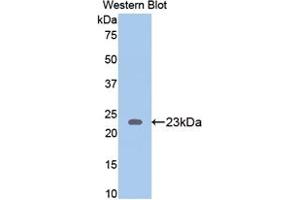 Western blot analysis of the recombinant protein. (Thrombospondin 1 Antikörper  (AA 71-259))