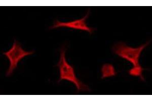 ABIN6267559 staining NIH-3T3 by IF/ICC. (BCAR1 Antikörper  (pTyr410))