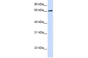 RUFY1 antibody used at 1 ug/ml to detect target protein. (RUFY1 Antikörper  (C-Term))