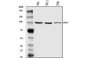 Western blot analysis of MSH2 using anti-MSH2 antibody (ABIN7601372).