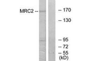 Western blot analysis of extracts from 293 cells, using MRC2 Antibody.