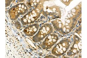 Phospho-TAO2 (Ser181) Antibody at 1/100 staining Rat colorectal tissue by IHC-P. (TAO Kinase 2 Antikörper  (pSer181))