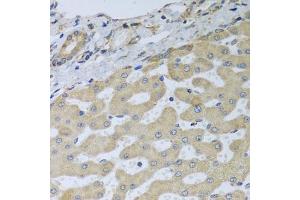 Immunohistochemistry of paraffin-embedded human liver injury using ATAD3B antibody. (ATAD3B Antikörper)