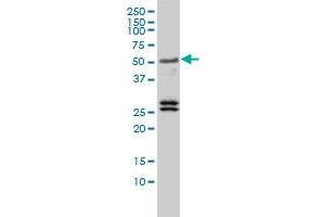 TFEB monoclonal antibody (M01), clone 3E1-G6 Western Blot analysis of TFEB expression in Jurkat (TFEB Antikörper  (AA 1-476))