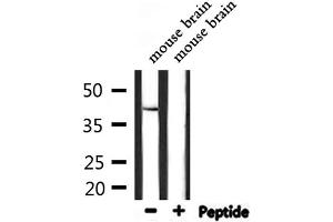 Western blot analysis of extracts from mouse brain, using STAC3 Antibody. (STAC3 Antikörper  (Internal Region))
