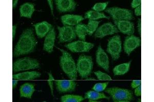 Immunofluorescence (IF) image for anti-Dihydrolipoyl Transacetylase (DLAT) antibody (ABIN7257932)