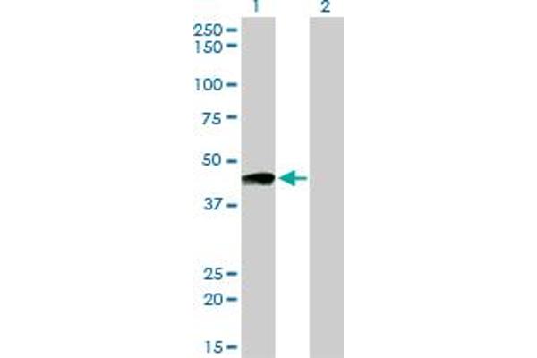 Prostacyclin Receptor Antikörper  (AA 296-386)