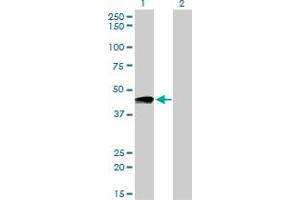 Western Blot analysis of PTGIR expression in transfected 293T cell line by PTGIR monoclonal antibody (M01), clone 4B10.