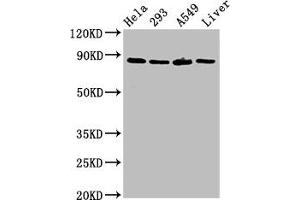 Western Blot Positive WB detected in: Hela whole cell lysate, 293 whole cell lysate, A549 whole cell lysate, Rat liver tissue All lanes: USP10 antibody at 3 μg/mL Secondary Goat polyclonal to rabbit IgG at 1/50000 dilution Predicted band size: 88, 93 kDa Observed band size: 88 kDa (USP1 Antikörper  (AA 453-592))