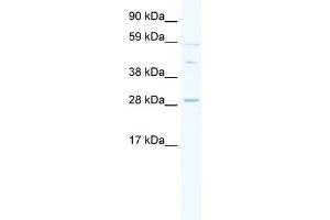 WB Suggested Anti-SPI1 Antibody Titration: 0. (SPI1 Antikörper  (Middle Region))