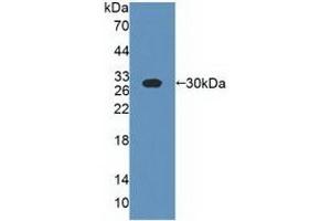 Detection of Recombinant CSN1, Bovine using Polyclonal Antibody to Casein Alpha (CSN1) (Casein alpha S1 Antikörper  (AA 16-187))