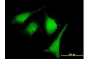 Immunofluorescence of purified MaxPab rabbit antibody to MAP2K2 on HeLa cell. (MEK2 Antikörper  (AA 1-400))
