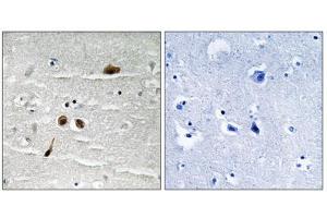 Immunohistochemistry analysis of paraffin-embedded human brain tissue using MDC1 (Phospho-Ser513) antibody. (MDC1 Antikörper  (pSer513))