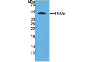 Western blot analysis of recombinant Human C4a. (C4A Antikörper  (AA 680-756))