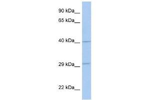 ART5 antibody used at 1 ug/ml to detect target protein. (ART5 Antikörper  (Middle Region))