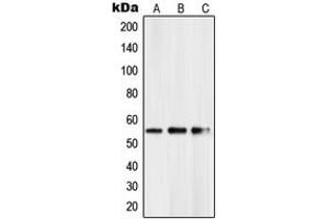 Western blot analysis of PKNOX2 expression in HeLa (A), mouse kidney (B), rat kidney (C) whole cell lysates.