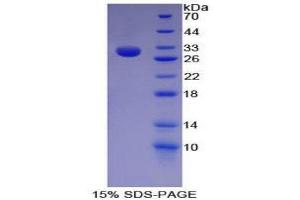SDS-PAGE (SDS) image for Histone Acetyltransferase 1 (HAT1) (AA 100-338) protein (His tag) (ABIN1879622)
