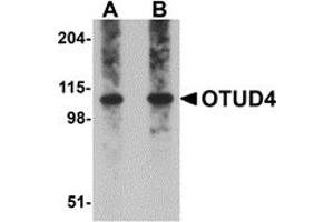 Western Blotting (WB) image for anti-OTU Domain Containing 4 (OTUD4) (C-Term) antibody (ABIN1030565) (OTUD4 Antikörper  (C-Term))