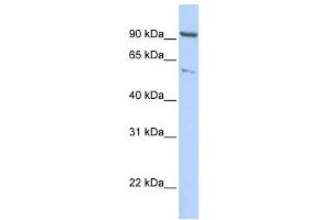 WB Suggested Anti-KIF2A Antibody Titration:  0. (KIF2A Antikörper  (C-Term))