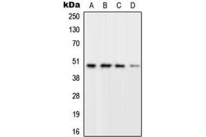 Western blot analysis of RPL3 expression in A549 (A), SP2/0 (B), PC12 (C), Human brain (D) whole cell lysates. (RPL3 Antikörper  (Center))