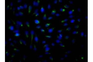 Immunofluorescence staining of Hela Cells with ABIN7127797 at 1:50, counter-stained with DAPI. (Rekombinanter ROCK2 Antikörper)