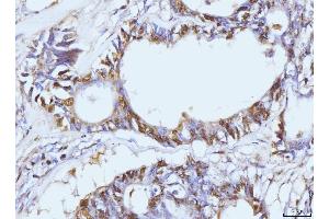 IHC analysis of PCNA using anti-PCNA antibody (ABIN7599181).