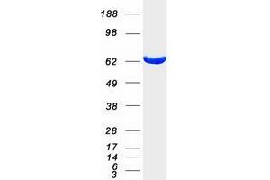 Western Blotting (WB) image for Malic Enzyme 1, NADP(+)-Dependent, Cytosolic (ME1) protein (Myc-DYKDDDDK Tag) (ABIN2726777)