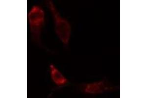 ABIN6275203 staining Hela cells by IF/ICC. (DCT Antikörper  (N-Term))
