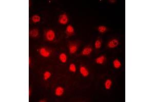 Immunofluorescent analysis of RB1 (pS780) staining in HeLa cells.