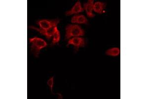ABIN6267685 staining MDA-MB-435 by IF/ICC. (ASK1 Antikörper  (pSer83))