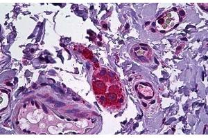 Human Intestine, Ganglion Cells: Formalin-Fixed, Paraffin-Embedded (FFPE) (NPY5R Antikörper  (AA 241-252))