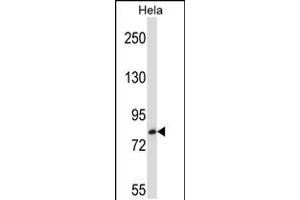 Western blot analysis in Hela cell line lysates (35ug/lane). (TRIM37 Antikörper  (C-Term))