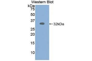 Detection of Recombinant ALDOA, Human using Polyclonal Antibody to Aldolase A, Fructose Bisphosphate (ALDOA) (ALDOA Antikörper  (AA 18-273))