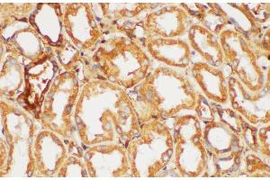 Immunohistochemistry of paraffin-embedded Human kidney using FGB Polycloanl Antibody at dilution of 1:200 (Fibrinogen beta Chain Antikörper)