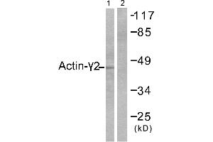 Western blot analysis of extracts from COLO205 cells, using Actin-γ2 antibody. (ACTG2 Antikörper)