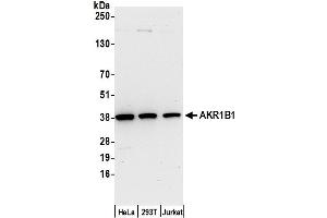 Western Blotting (WB) image for anti-Aldo-Keto Reductase Family 1, Member B1 (Aldose Reductase) (AKR1B1) (AA 100-150) antibody (ABIN7453025)