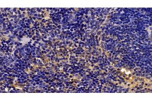 Immunohistochemistry (IHC) image for anti-Caspase 1 (CASP1) (AA 317-404) antibody (ABIN7438055)