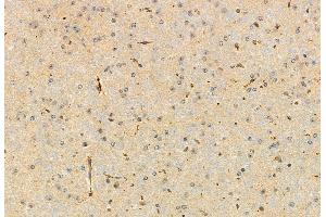ABIN6264200 and ABIN6272927 at 1/100 staining Mouse brain tissue by IHC-P.