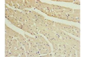 Immunohistochemistry of paraffin-embedded human heart tissue using ABIN7151077 at dilution of 1:100