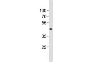 Western blot analysis of lysate from human kidney tissue lysate using SOX7 antibody diluted at 1:1000. (SOX7 Antikörper  (AA 224-258))